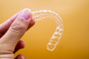 Invisalign Relapse Prevention