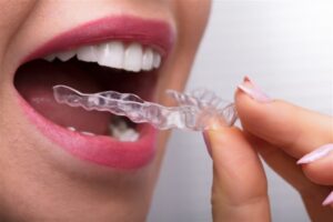 Invisalign or Braces: Which Option Delivers Faster Results for Teens?