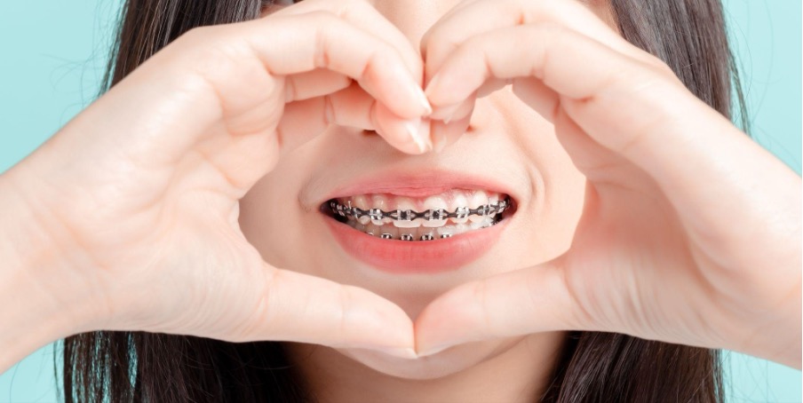 Cost of Braces