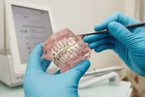 Cost of Braces in Oakhurst: 5 Factors to Consider 1 Cost of Braces